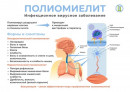 Профилактика полиомиелита